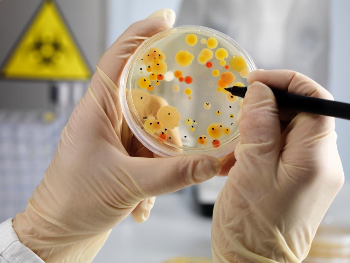 Image of bacterial colonies growing on an agar growth medium
