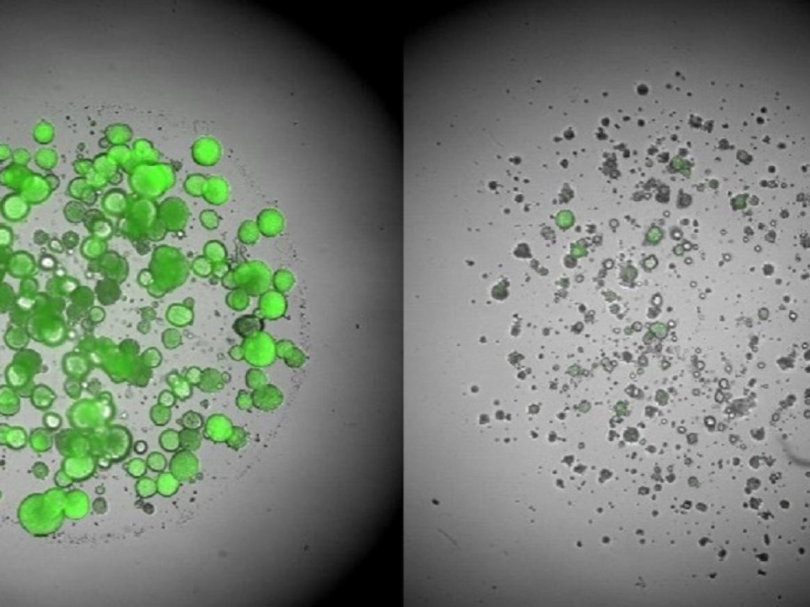 Image comparing triple negative breast cancer cells before and after treatment. Taken from under a microscope, the cells on the left are bright green. The cells on the right are grey.