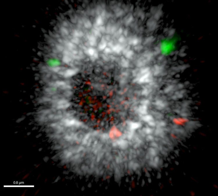Differences in short (red) and long (green) 5S rDNA reads in a duckweed nucleus.