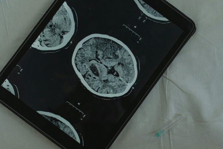 A scan of a brain on a tablet