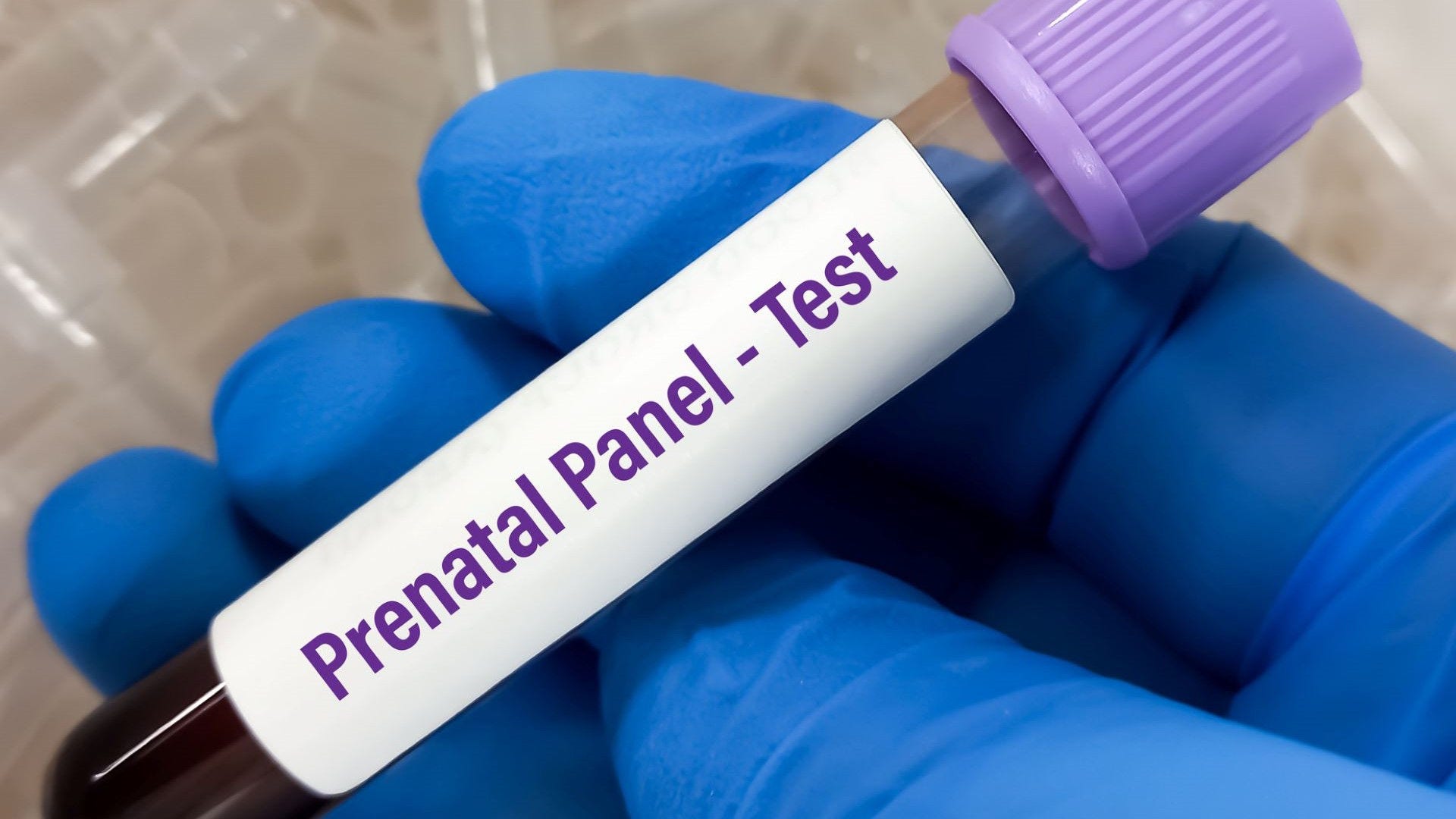 Prenatal blood test tube