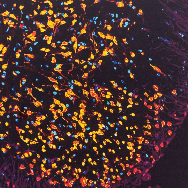 Microscopy image