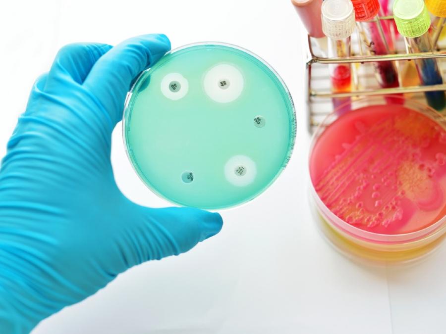 Image of antibiotic resistance testing