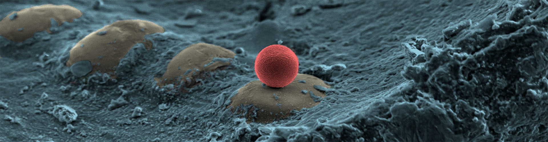 Electron microscope image