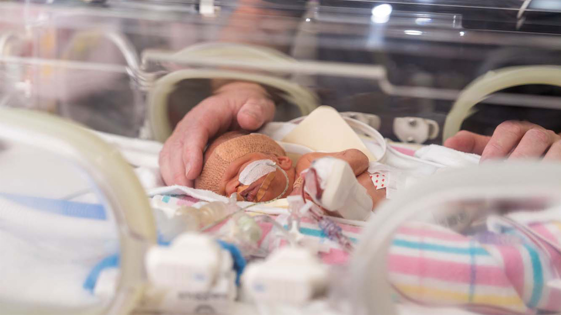 Neonatal baby in the hospital