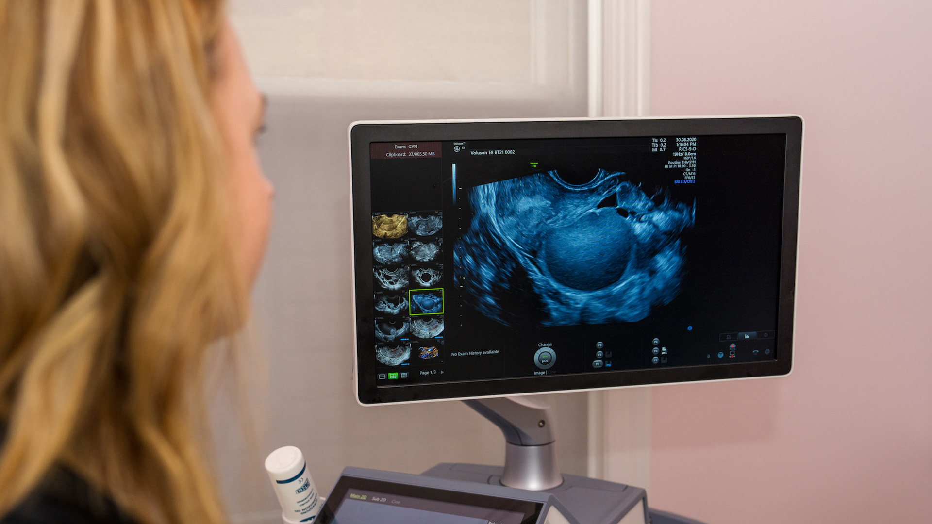 Harnessing AI to revolutionise endometriosis diagnosis