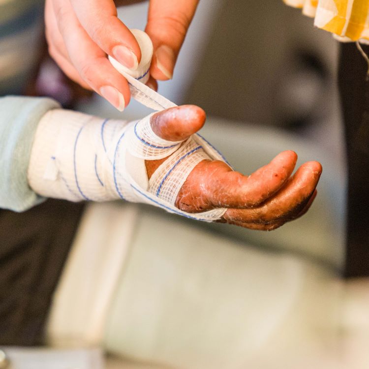 Image of a bandaged hand
