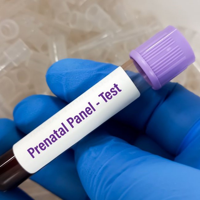 prenatal blood test tube