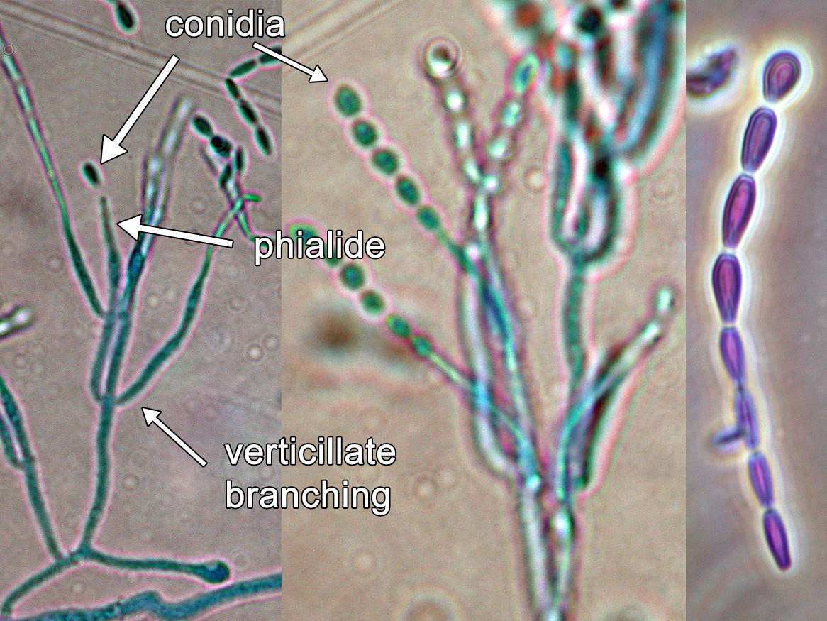 Microscopy - branches bearing phialides