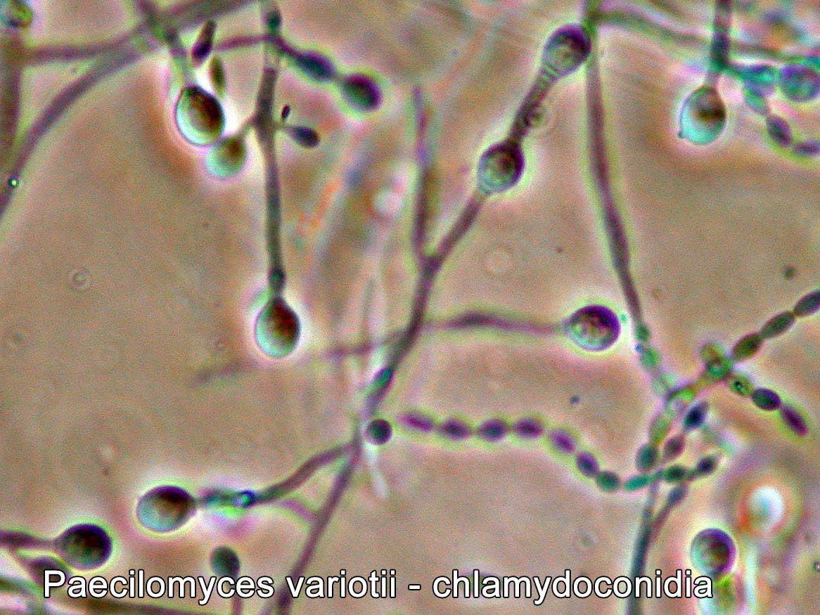 Microscopy - Chlamydoconidia