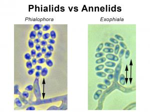 Phialides vs annelides