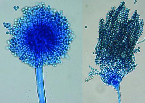 Conidial heads of Aspergillus flavus. Note: conidial heads with both uniseriate and biseriate arrangement of phialides may be present.