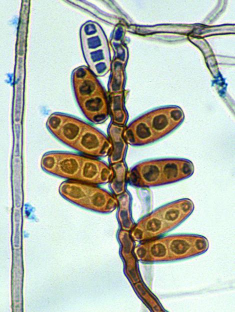 Curvularia australiensis showing sympodial development of pale brown, fusiform to ellipsoidal, pseudoseptate, poroconidia on a geniculate or zig-zag rachis.