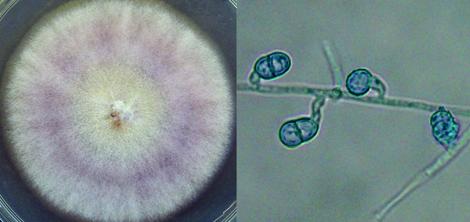 Culture and chlamydospores of Cylindrocarpon spp