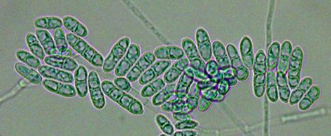 Macroconidia of Cylindrocarpon spp