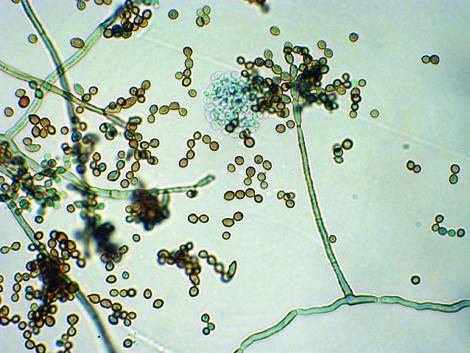 Fonsecaea complex conidiophores and conidia