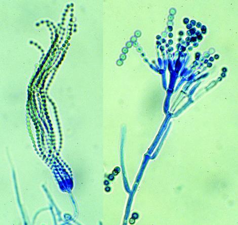 structure of penicillium mold