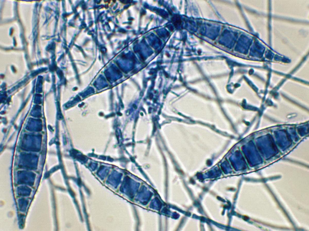 Microsporum canis microscopy