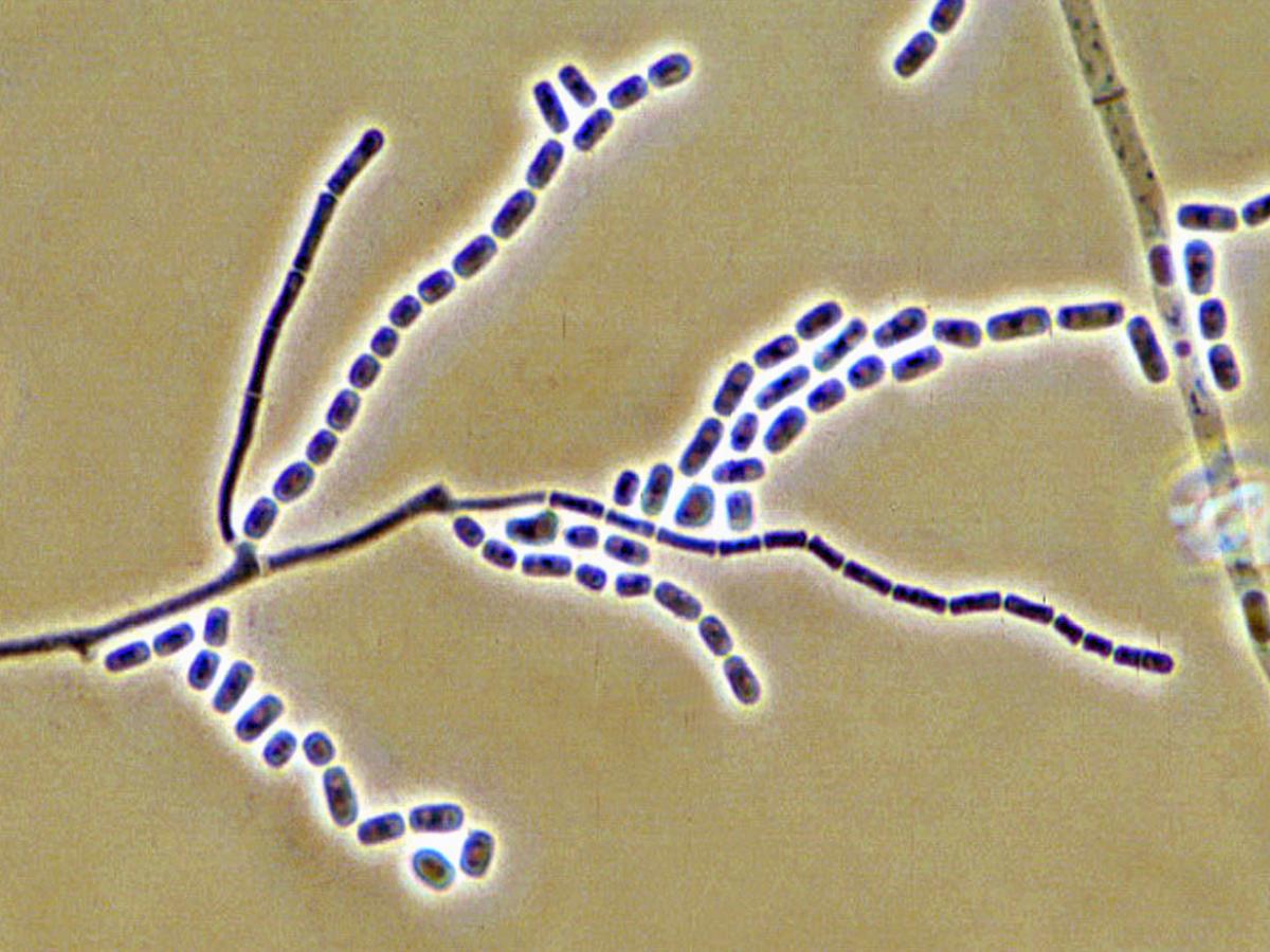 Candida geotrichum store