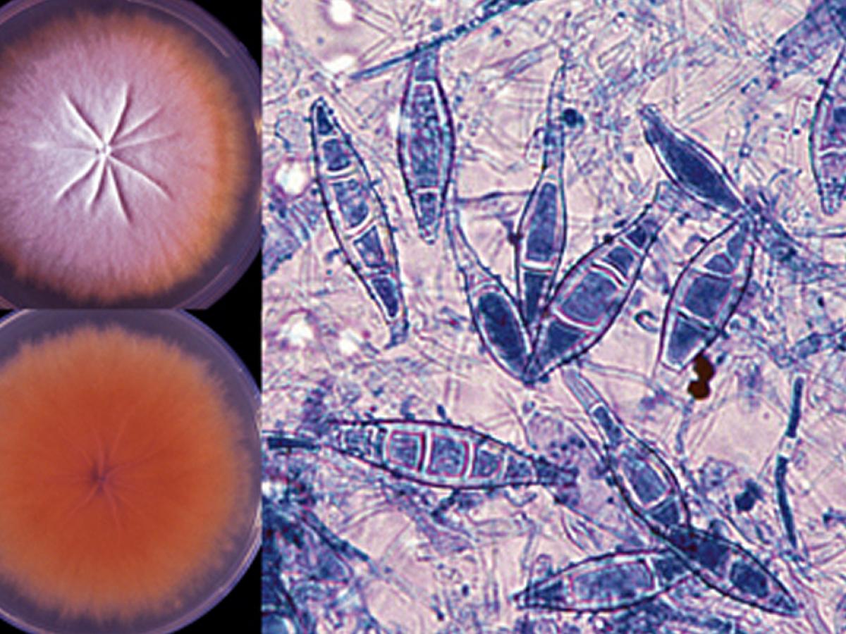 Microsporum canis возбудитель