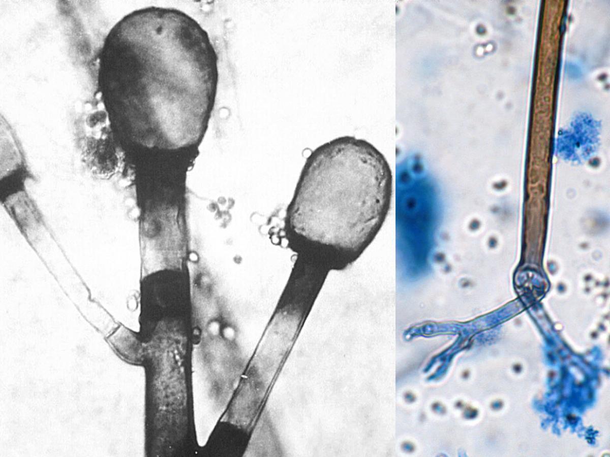 Rhizomucor sporangia