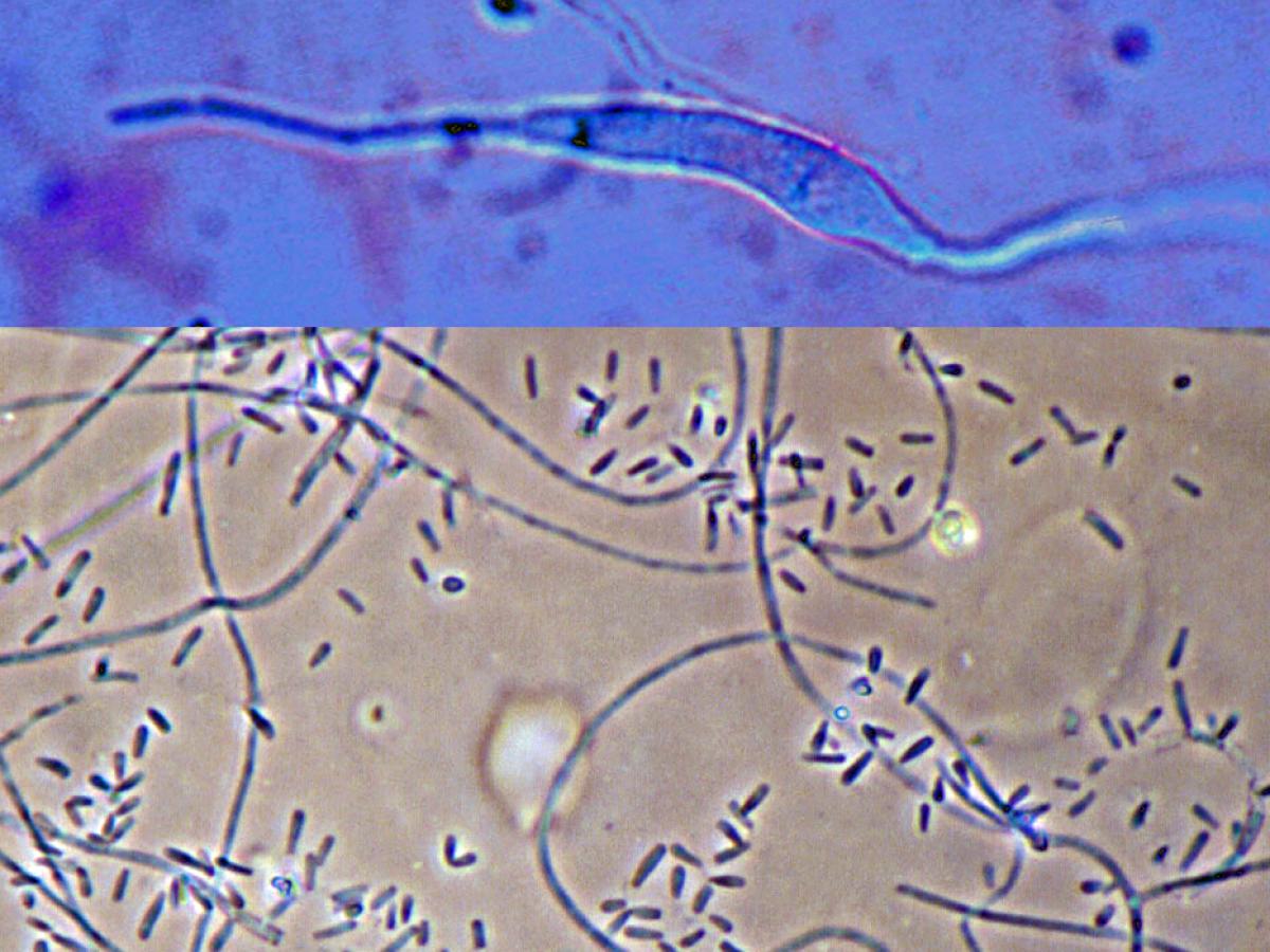 Trichophyton verrucosum micro