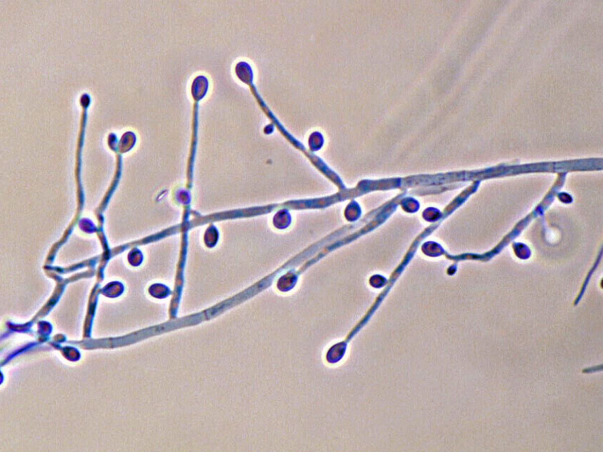 Unknown 11 microscopy