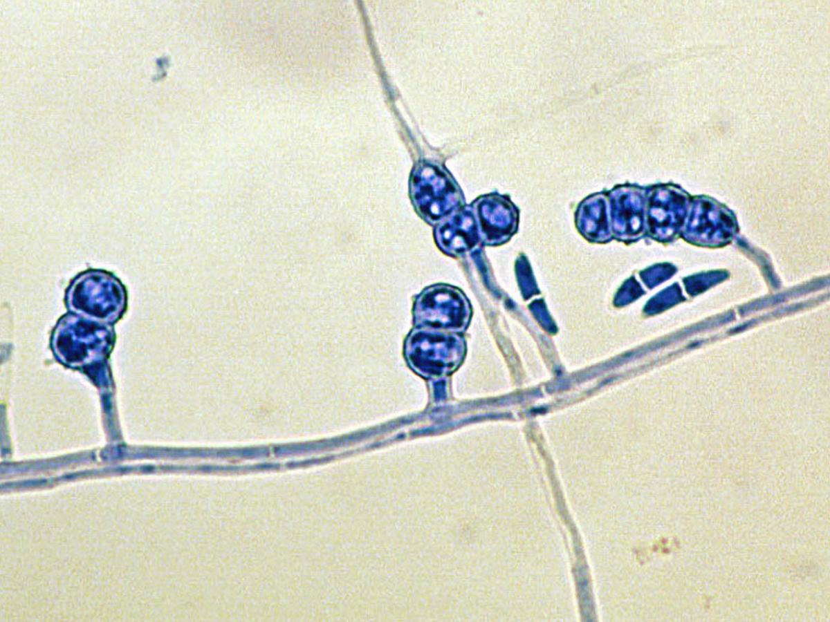 Unknown 14 microscopy - 3