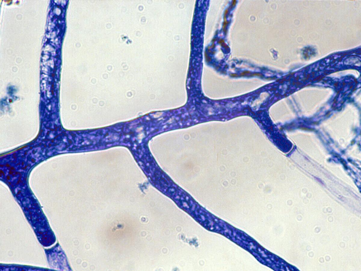 Unknown 15 microscopy - 1