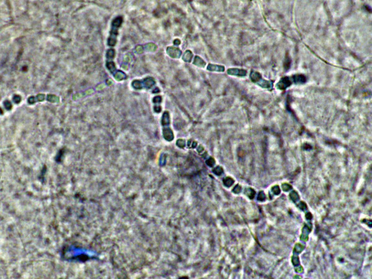 Unknown 24 direct microscopy (KOH mount)