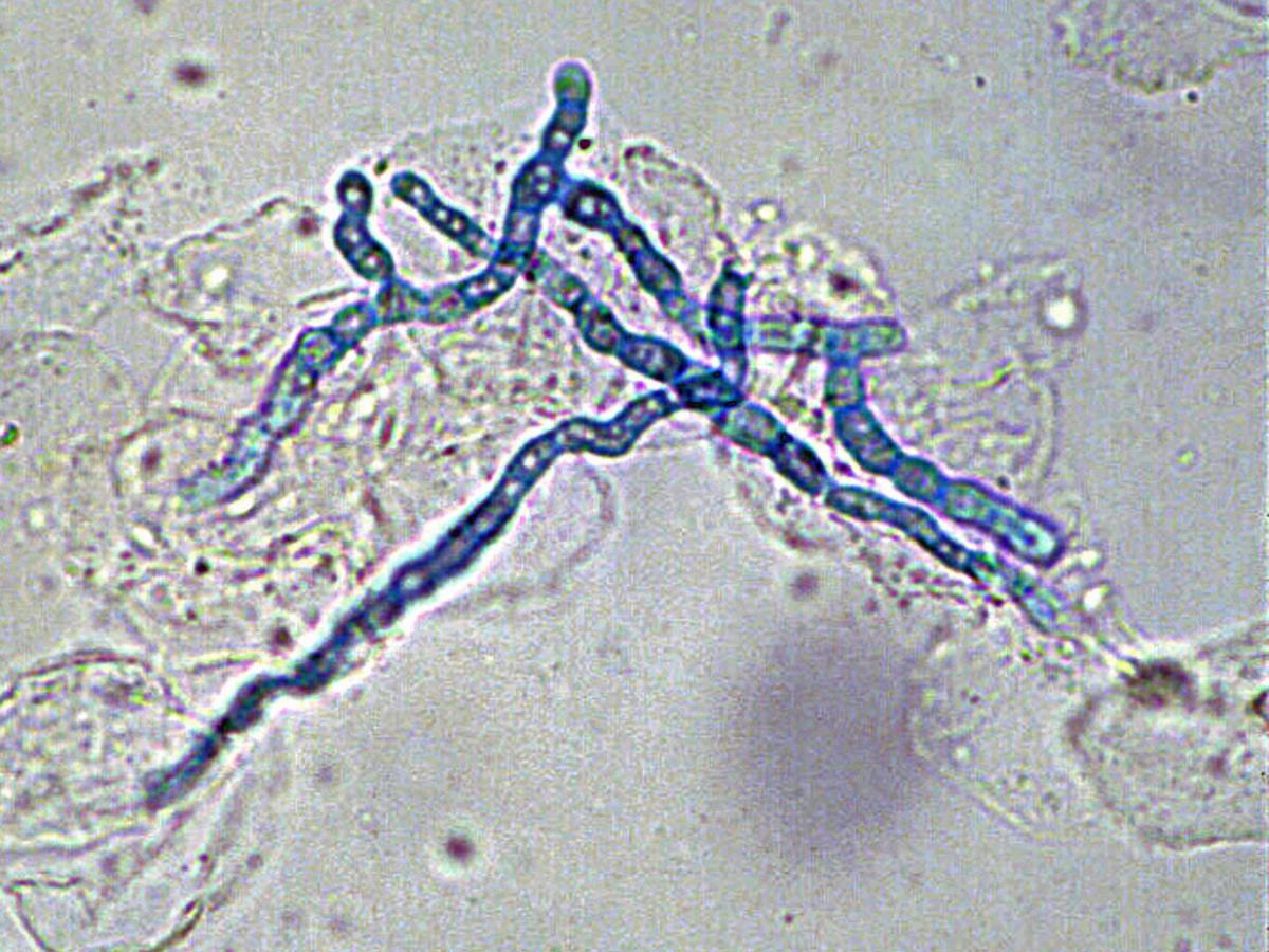 Unknown 27 direct microscopy (H&E)