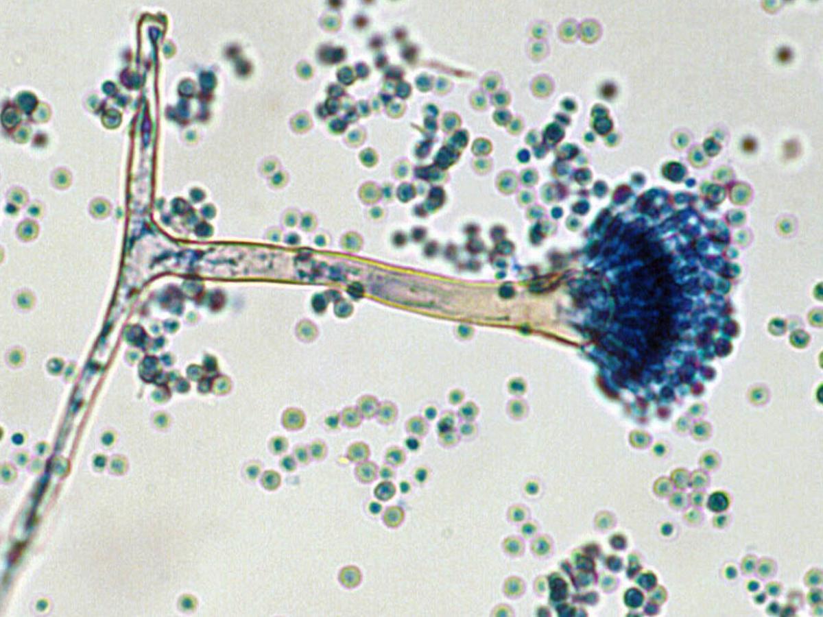 Unknown 29 microscopy - 1