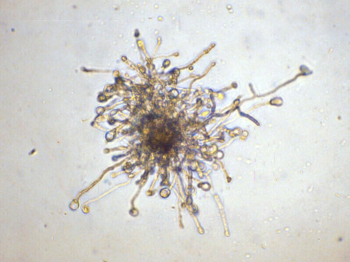Unknown 38 microscopy - 1