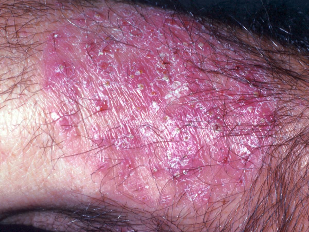 Unknown 47 clinical presentation