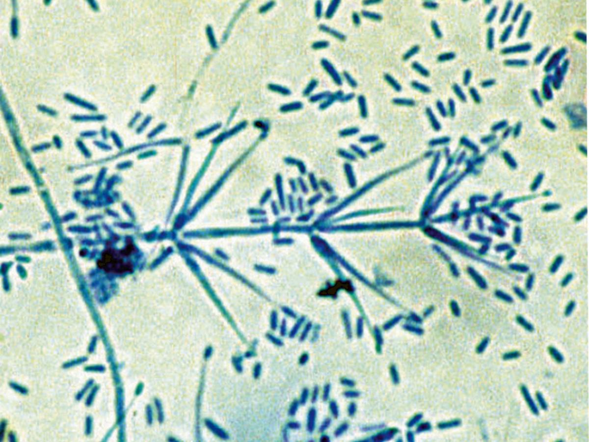 Verticillium | Mycology | University Of Adelaide