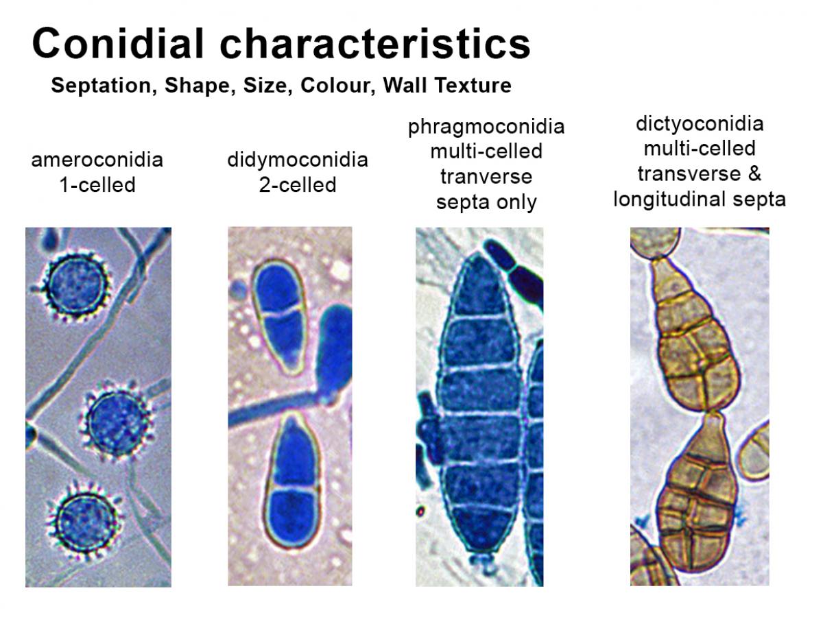 Hyphomycetes (Conidial Moulds) | Mycology | University Of Adelaide