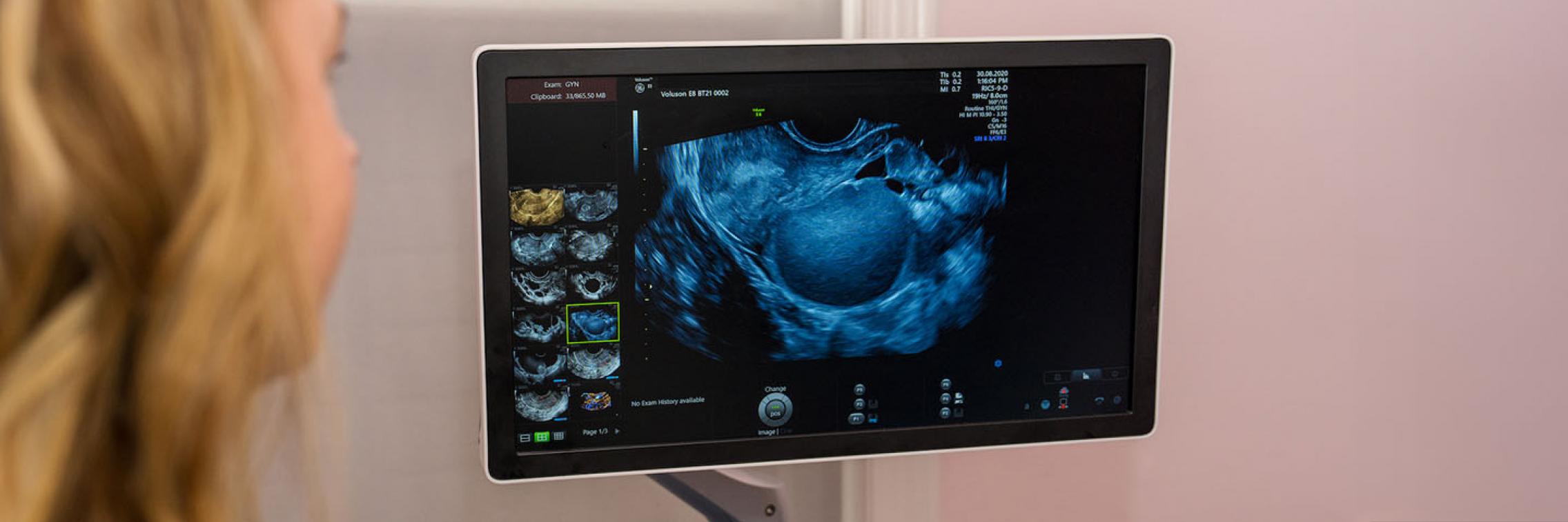 A doctor analysing an ultrasound image